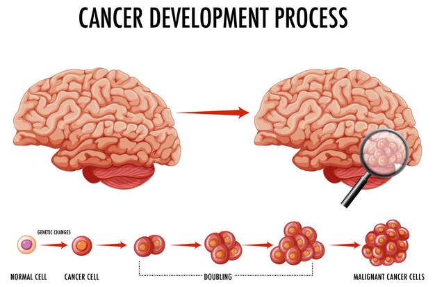 Диаграмма, показывающая человеческий мозг и рак