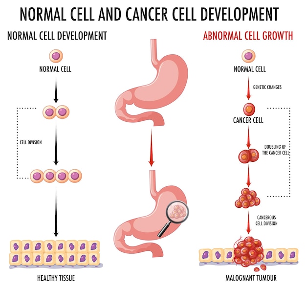 無料ベクター 正常細胞と癌細胞を示す図