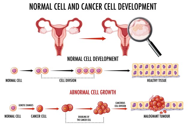 무료 벡터 정상 세포와 암세포를 보여주는 다이어그램