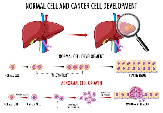 Diagramma che mostra la cellula normale e quella cancerosa