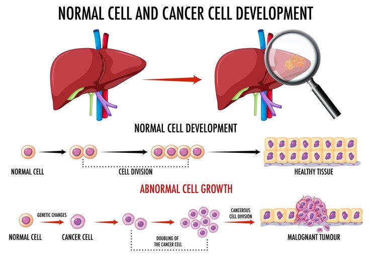Free Vector diagram showing normal and cancer cell