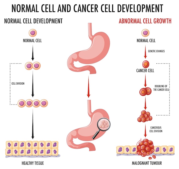 Diagramma che mostra la cellula normale e quella cancerosa