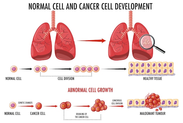 Vettore gratuito diagramma che mostra la cellula normale e quella cancerosa