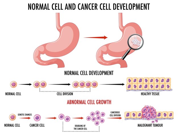 Diagramma che mostra la cellula normale e quella cancerosa