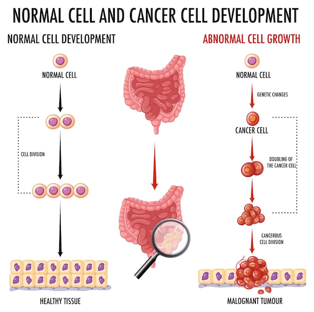 Diagram showing normal and cancer cell