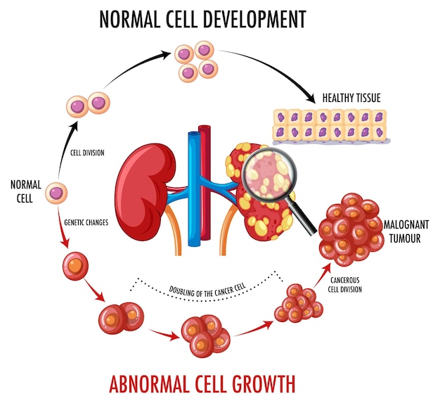 Vettore gratuito diagramma che mostra la cellula normale e quella cancerosa