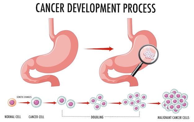 Diagramma che mostra le cellule normali e cancerose nell'uomo