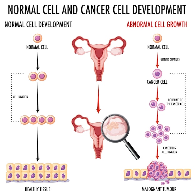 Free vector diagram showing normal and cancer cells in human