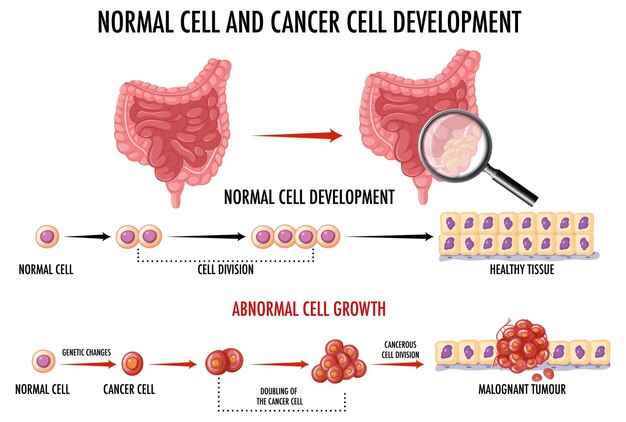 Diagram showing normal and cancer cells in human