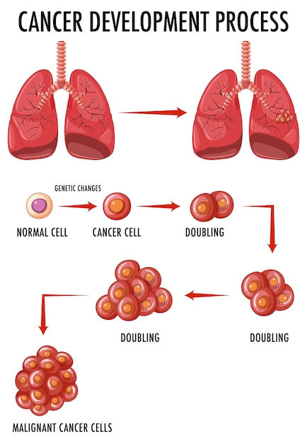 Diagramma che mostra le cellule normali e cancerose nell'uomo