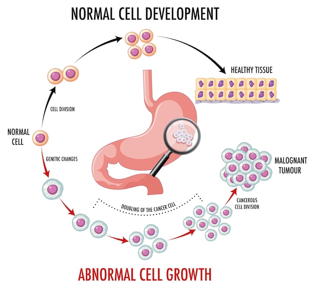 Vettore gratuito diagramma che mostra le cellule normali e cancerose