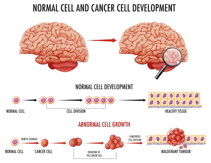 Free Vector diagram showing normal cell and cancer cell