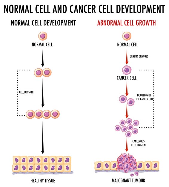 Diagram showing normal cell and cancer cell