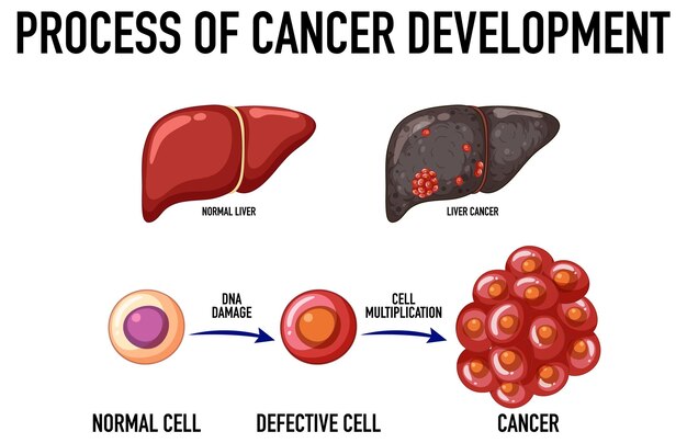 Free vector diagram showing process of cancer development