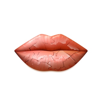 Illustrazione di labbra secche