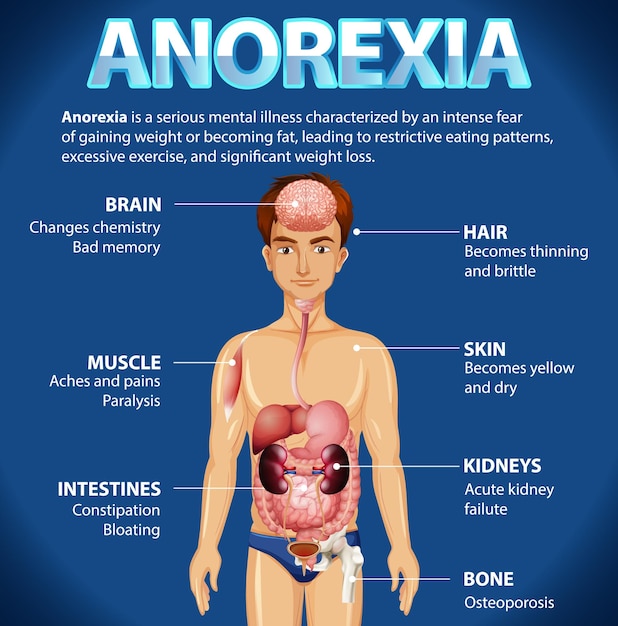 無料ベクター アノレキシア が 男性 の 解剖学 に 及ぼす 影響