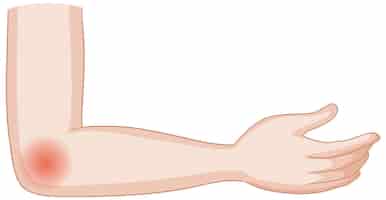 Free vector elbow pain illustration