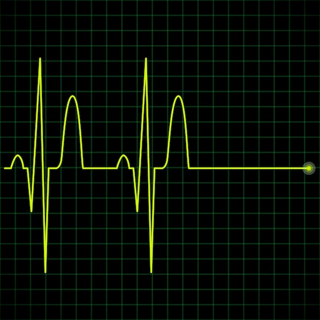 Electronic graph in yellow color