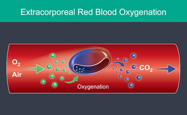 체외 적혈구 산소화. 상업적 사용을 위한 삽화, 적혈구에 대하여 호흡과 심장으로 산소 분자를 받았습니다. 인포 그래픽 벡터입니다.
