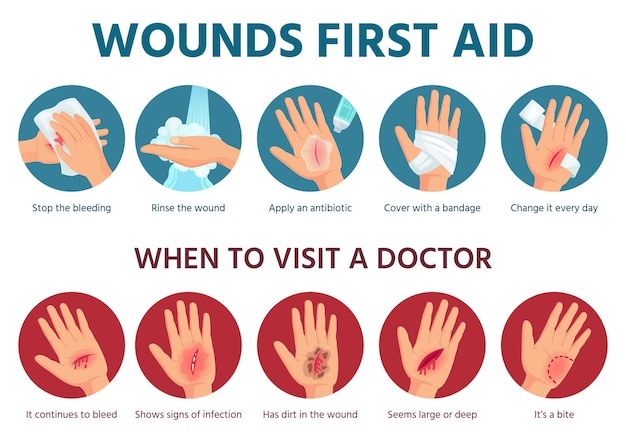 First aid for wound on skin. treatment procedure for bleeding cut. bandage on injured palm. emergency situation safety infographic in vector. illustration aid skin, injury and trauma