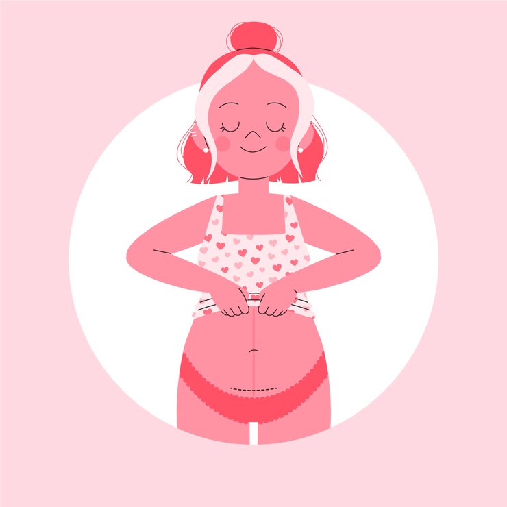 Free Vector flat design cesarean section horizontal incision