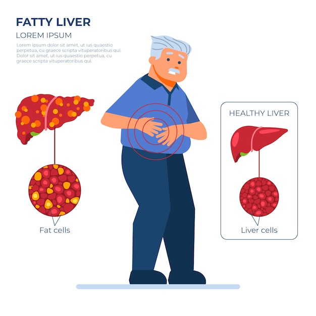 Flat design fatty liver illustration