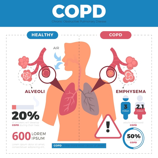 Modello di infografica copd disegnato a mano piatta