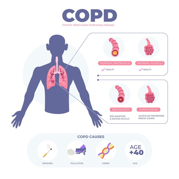 Modello di infografica copd disegnato a mano piatta