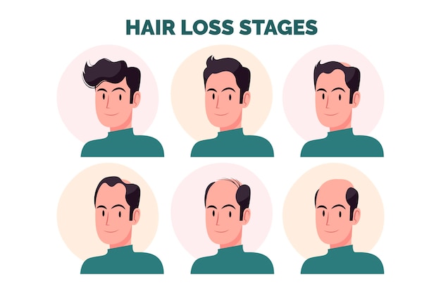 Flat-hand drawn hair loss stages illustration with man