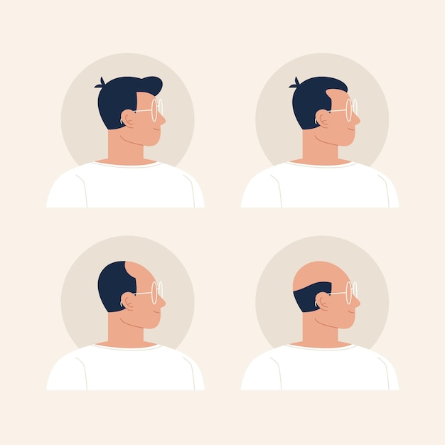 Free vector flat-hand drawn hair loss stages illustration