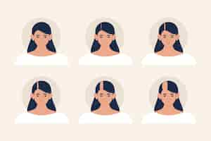 Free vector flat-hand drawn hair loss stages illustration