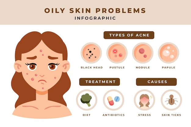 Flat-hand drawn oily skin problems infographic template