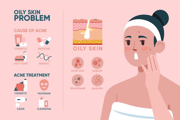 Flat-hand drawn oily skin problems infographic