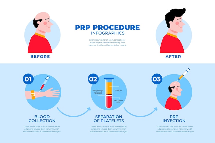 Free Vector flat-hand drawn prp procedure infographic