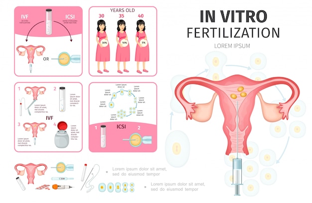 人工授精のための妊娠中の女性の精子準備受精卵開発医療ツールとフラット体外受精インフォグラフィック