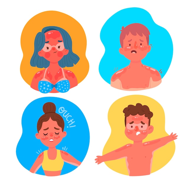 Flat people with a sunburn collection