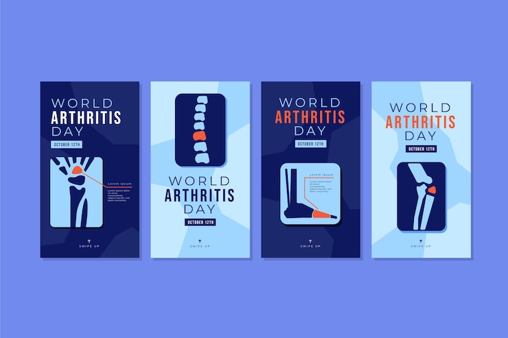 7 Common Causes of Osteoarthritis and Rheumatoid arthritis