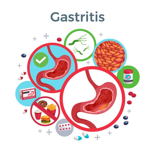 Gastritis disease symptoms causes medicine flat circular composition of healthy and affected stomach bacteria food