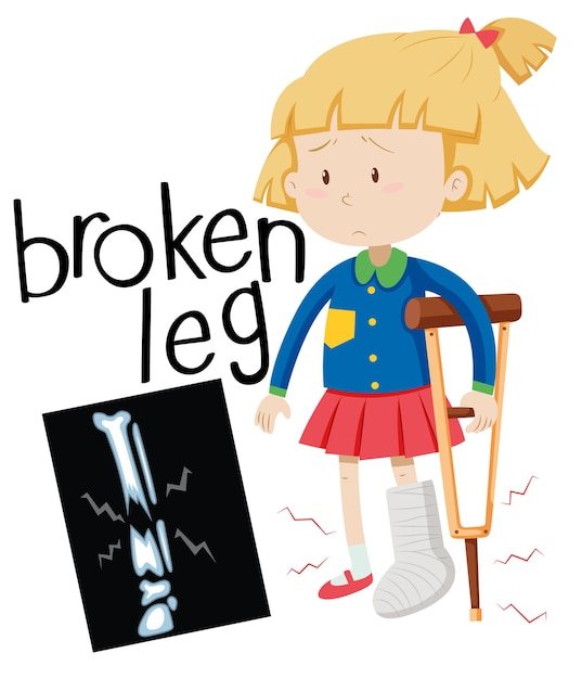 Free vector girl with broken leg and x-ray film