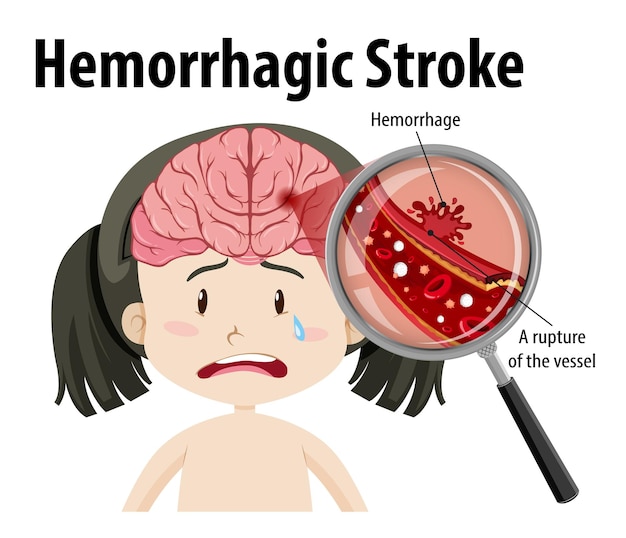 Free vector girl with hemorrhagic stroke