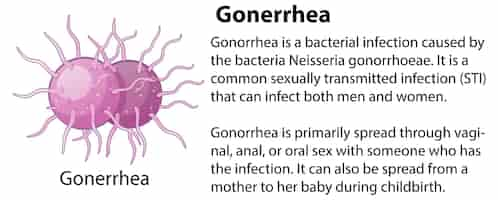 Free vector gonorrhea virus with explanation