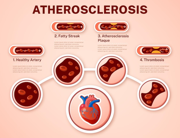 Vettore gratuito gradiente di sangue infografica