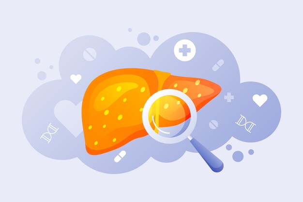 Gradient fatty liver illustration