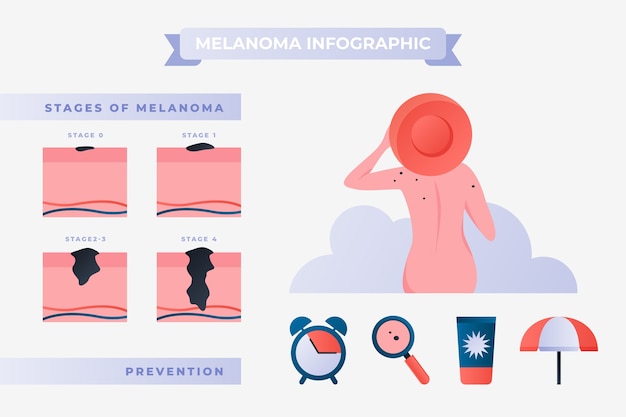 Vettore gratuito infografica sul melanoma a gradiente