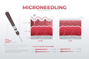 Бесплатное векторное изображение Инфографика градиентного микронидлинга