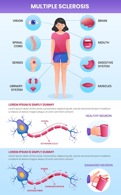 무료 벡터 그라데이션 다발성 경화증 infographic