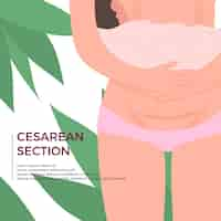 Free vector hand drawn cesarean section illustration