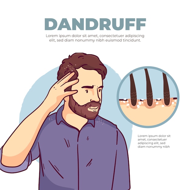 Free vector hand drawn dandruff infographic