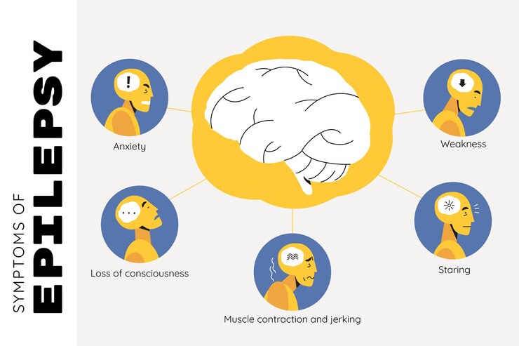 Free Vector hand drawn flat design epilepsy infographic