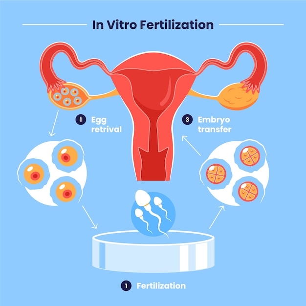 Free vector hand drawn flat design ivf infographic
